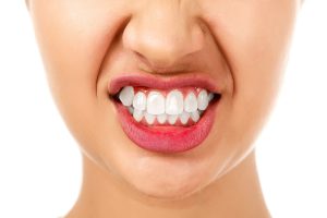A woman showing off her receding gums before finding treatment