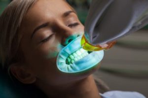 A woman receiving in-house whitening treatment at Cobblestone Dentistry instead of take-home whitening trays