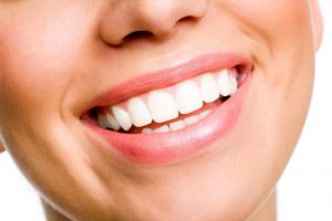 Women who had cosmetic dentistry services for a beautiful smile