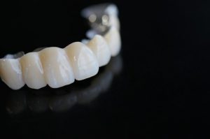 Dental bridge that will be used on a Cobblestone Park Family Dental patient