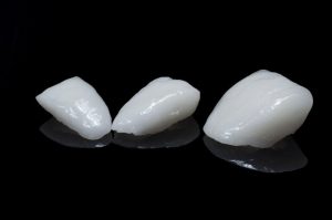 Porcelain veneers