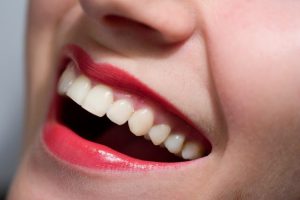 Woman smiling with tooth-colored fillings