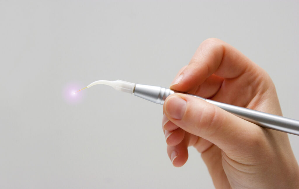 hand holding a dental laser